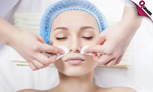 Chemical Peeling Treatment for Face!